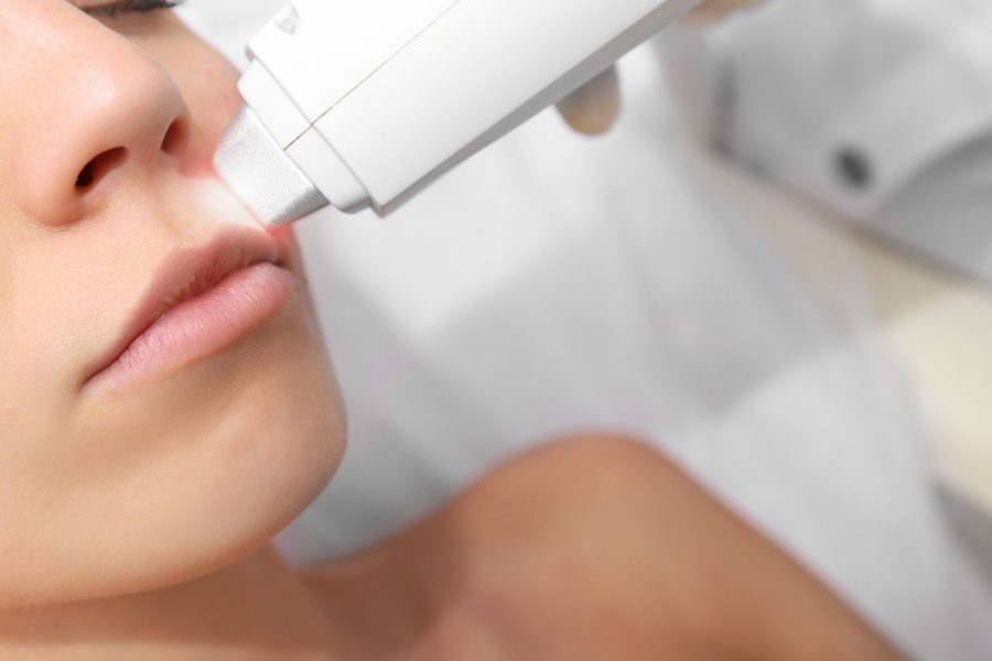 Upper Lip Laser Hair Removal Treatment at Le Parlour NYC